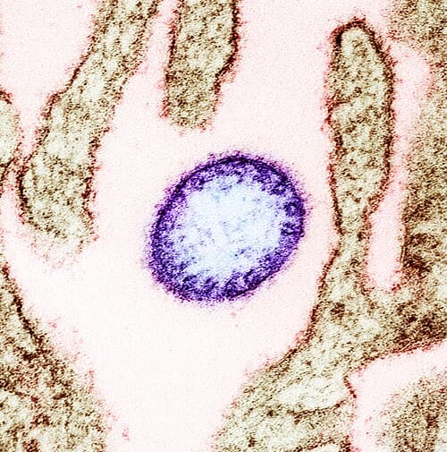 Cover Image for The Nipah Virus